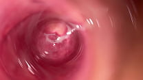 Camera inside teen creamy vagina